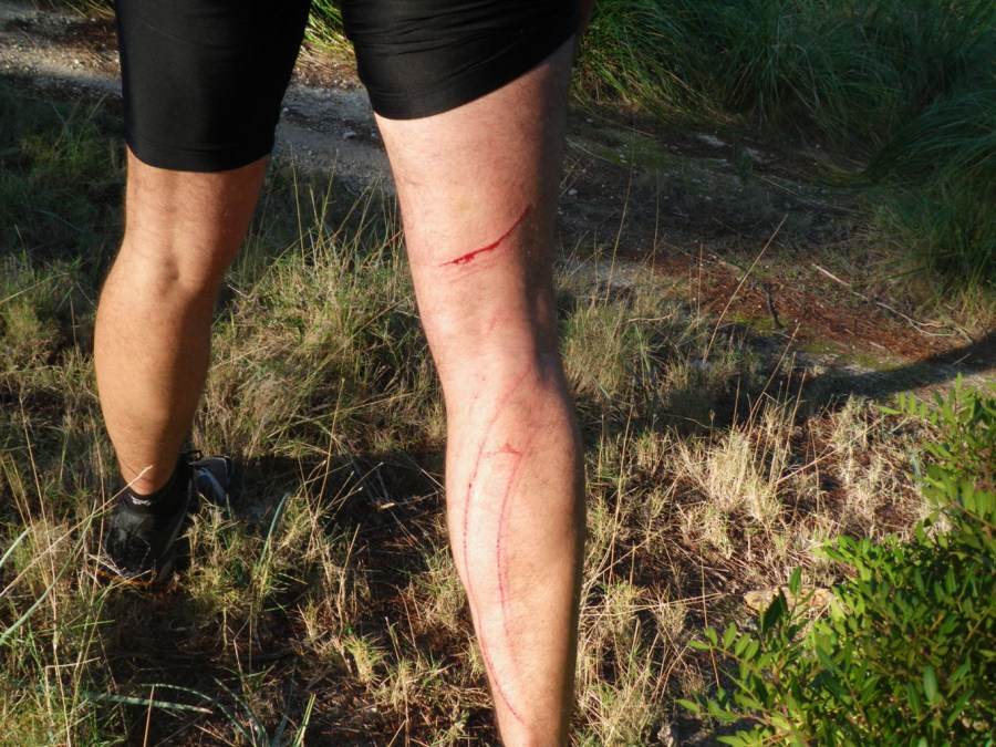 segundo contratiempo